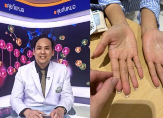 โรคเหงื่อมือ-เท้า พัฒนาการรักษาเพื่อคนไทย